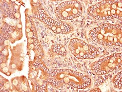 Invitrogen TGFBR1 Polyclonal Antibody 100 &mu;L; Unconjugated:Antibodies,