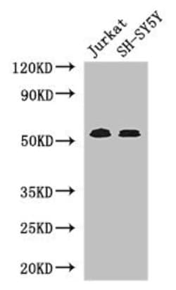 Invitrogen TGFBR1 Polyclonal Antibody 100 &mu;L; Unconjugated:Antibodies,