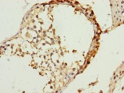 Invitrogen TIMM23 Polyclonal Antibody 100 &mu;L; Unconjugated:Antibodies,