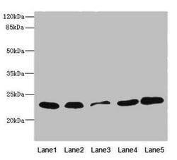 Invitrogen TIMM23 Polyclonal Antibody 100 &mu;L; Unconjugated:Antibodies,