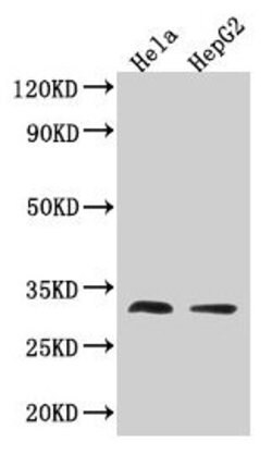 Invitrogen TMEM192 Polyclonal Antibody 100 &mu;g; Unconjugated:Antibodies,
