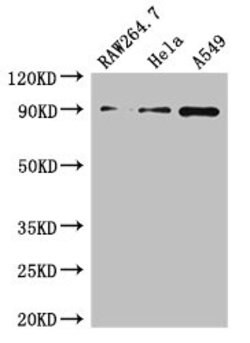 Invitrogen A20 Polyclonal Antibody 100 &mu;g | Buy Online | Invitrogen&trade; | Fisher Scientific