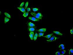 Invitrogen ENO1 Polyclonal Antibody 100 &mu;g; Unconjugated:Antibodies,