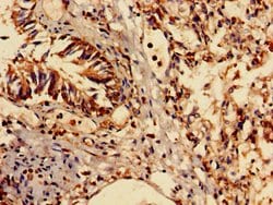 Invitrogen ENO1 Polyclonal Antibody 100 &mu;g; Unconjugated:Antibodies,