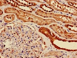 Invitrogen ENO1 Polyclonal Antibody 100 &mu;g; Unconjugated:Antibodies,