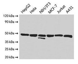 Invitrogen ENO1 Polyclonal Antibody 100 &mu;g; Unconjugated:Antibodies,
