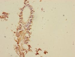Invitrogen TNFAIP8 Polyclonal Antibody 100 &mu;L; Unconjugated:Antibodies,