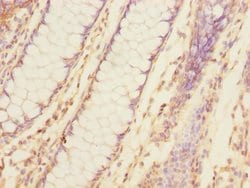 Invitrogen TNFAIP8 Polyclonal Antibody 100 &mu;L; Unconjugated:Antibodies,