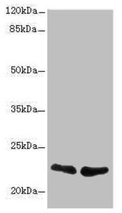 Invitrogen TNFAIP8 Polyclonal Antibody 100 &mu;L; Unconjugated:Antibodies,