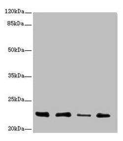 Invitrogen TNFAIP8 Polyclonal Antibody 100 &mu;L | Buy Online | Invitrogen&trade; | Fisher Scientific