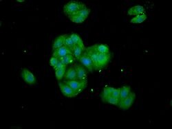 Invitrogen Tankyrase Polyclonal Antibody 100 &mu;g; Unconjugated:Antibodies,