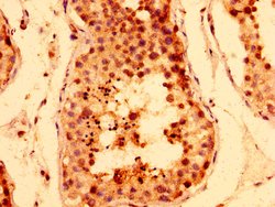 Invitrogen Tankyrase Polyclonal Antibody 100 &mu;g; Unconjugated:Antibodies,