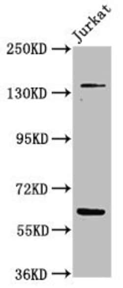 Invitrogen Tankyrase Polyclonal Antibody 100 &mu;g; Unconjugated:Antibodies,