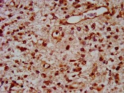 Invitrogen TOX Polyclonal Antibody 100 &mu;g; Unconjugated:Antibodies,