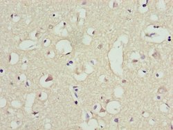Invitrogen RFP2 Polyclonal Antibody 100 &mu;L; Unconjugated:Antibodies,