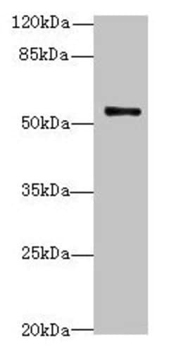Invitrogen TRIM38 Polyclonal Antibody 100 &mu;g; Unconjugated:Antibodies,