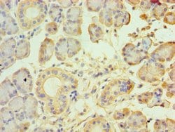 Invitrogen TRPM2 Polyclonal Antibody 100 &mu;L; Unconjugated:Antibodies,
