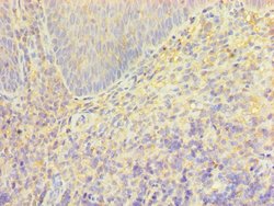 Invitrogen TRPM2 Polyclonal Antibody 100 &mu;L; Unconjugated:Antibodies,