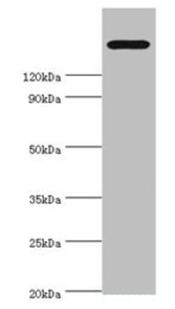 Invitrogen TRPM2 Polyclonal Antibody 100 &mu;L; Unconjugated:Antibodies,