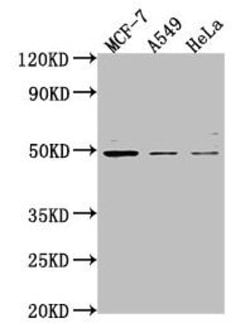 Invitrogen TSKU Polyclonal Antibody 100 &mu;L | Buy Online | Invitrogen&trade; | Fisher Scientific