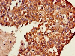 Invitrogen TXK Polyclonal Antibody 100 &mu;g; Unconjugated:Antibodies,