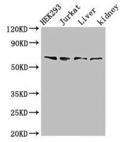 Invitrogen TXK Polyclonal Antibody 100 &mu;g; Unconjugated:Antibodies,