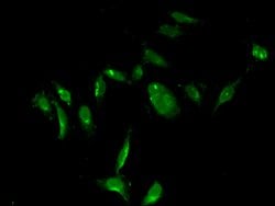 Invitrogen Thymidylate Synthase Polyclonal Antibody 100 &mu;g; Unconjugated:Antibodies,