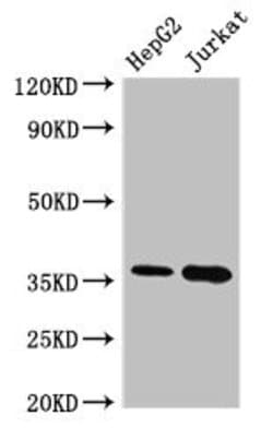 Invitrogen Thymidylate Synthase Polyclonal Antibody 100 &mu;g; Unconjugated:Antibodies,