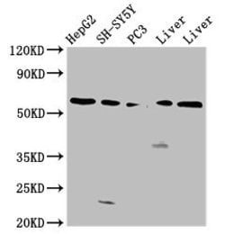 Invitrogen UGT1A1 Polyclonal Antibody 100 &mu;g | Buy Online | Invitrogen&trade; | Fisher Scientific