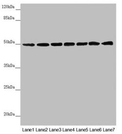 Invitrogen UQCRC1 Polyclonal Antibody 100 &mu;L; Unconjugated:Antibodies,