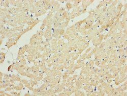 Invitrogen UQCRC2 Polyclonal Antibody 100 &mu;L; Unconjugated:Antibodies,