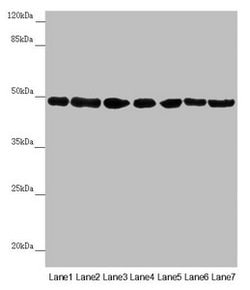 Invitrogen UQCRC2 Polyclonal Antibody 100 &mu;L; Unconjugated:Antibodies,
