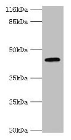 Invitrogen USP12 Polyclonal Antibody 100 &mu;g; Unconjugated:Antibodies,