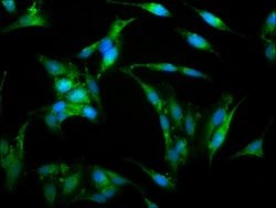 Invitrogen WASP Polyclonal Antibody 100 &mu;g | Buy Online | Invitrogen&trade; | Fisher Scientific