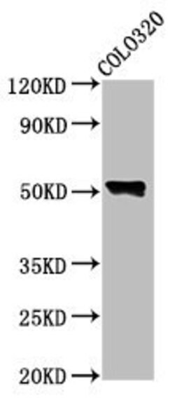 Invitrogen WASP Polyclonal Antibody 100 &mu;g | Buy Online | Invitrogen&trade; | Fisher Scientific