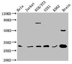 Invitrogen 14-3-3 gamma Polyclonal Antibody 100 &mu;g | Buy Online | Invitrogen&trade; | Fisher Scientific