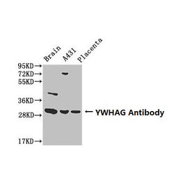 Invitrogen 14-3-3 gamma Polyclonal Antibody 100 &mu;g | Buy Online | Invitrogen&trade; | Fisher Scientific