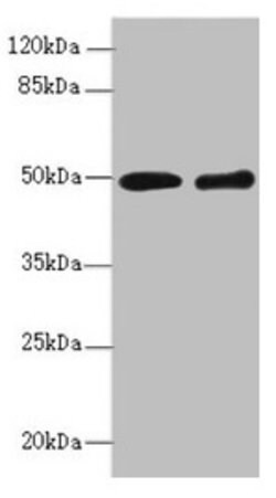Invitrogen ZBTB25 Polyclonal Antibody 100 &mu;L; Unconjugated:Antibodies,