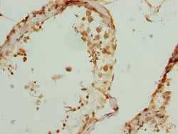 Invitrogen ZBTB25 Polyclonal Antibody 100 &mu;L; Unconjugated:Antibodies,