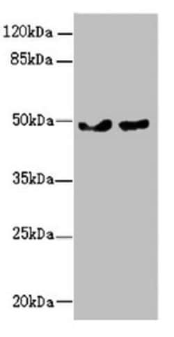 Invitrogen ZBTB25 Polyclonal Antibody 100 &mu;L; Unconjugated:Antibodies,