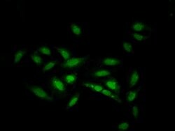 Invitrogen ZNF133 Polyclonal Antibody 100 &mu;g | Buy Online | Invitrogen&trade; | Fisher Scientific