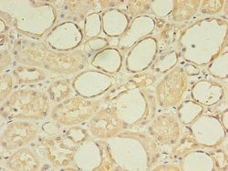 Invitrogen ZNF133 Polyclonal Antibody 100 &mu;g | Buy Online | Invitrogen&trade; | Fisher Scientific