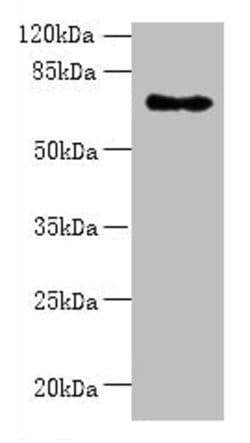 Invitrogen ZNF133 Polyclonal Antibody 100 &mu;g | Buy Online | Invitrogen&trade; | Fisher Scientific