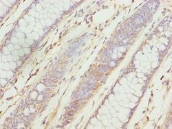 Invitrogen ZNF169 Polyclonal Antibody 100 &mu;L; Unconjugated:Antibodies,