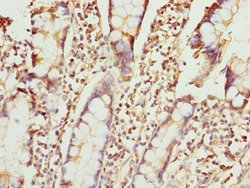 Invitrogen ZNF169 Polyclonal Antibody 100 &mu;L; Unconjugated:Antibodies,