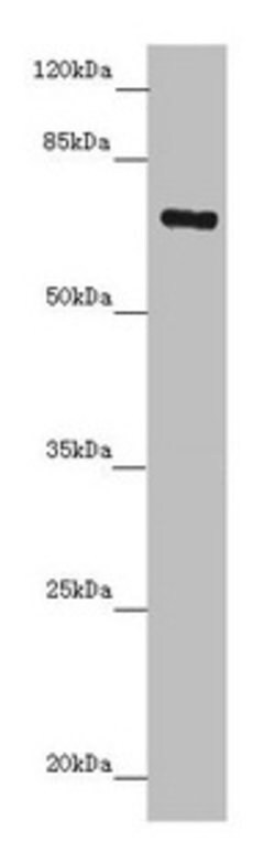 Invitrogen ZNF169 Polyclonal Antibody 100 &mu;L; Unconjugated:Antibodies,