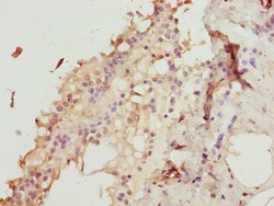 Invitrogen ZNF24 Polyclonal Antibody 100 &mu;L | Buy Online | Invitrogen&trade; | Fisher Scientific