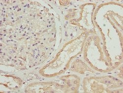 Invitrogen ZNF24 Polyclonal Antibody 100 &mu;L | Buy Online | Invitrogen&trade; | Fisher Scientific