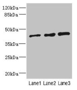 Invitrogen ZNF24 Polyclonal Antibody 100 &mu;L | Buy Online | Invitrogen&trade; | Fisher Scientific