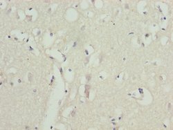 Invitrogen ZNF264 Polyclonal Antibody 100 &mu;L; Unconjugated:Antibodies,